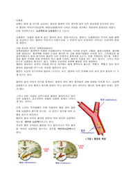 뇌졸중