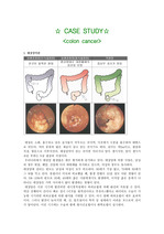 [성인간호학] 대장암