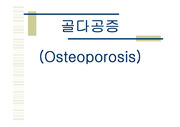 골다공증