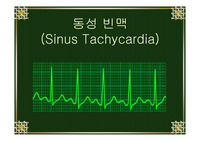 의학]Ekg 에 관해서 레포트