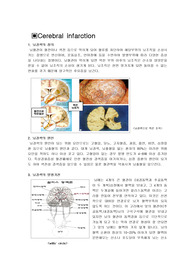 [신경외과학]뇌경색의 정의및 증상, 치료