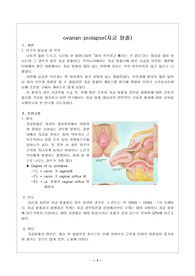 [모성간호학]부인과 케이스-자궁탈출 - 자궁탈출,모성간호학, 모성간호 케이스, 자궁탈출증, 자궁 탈출증, 자궁탈출 케이스, 자궁탈출 case, 자궁탈출 케이스스터디, 부인과, case study