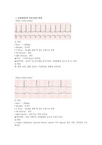 [간호학]부정맥의 종류