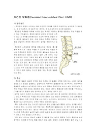 [간호학]추간판탈출증(HIVD)