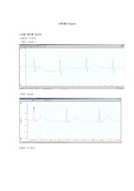 [의학]EKG실험(심전도 실험 레포트)