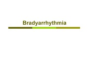 [의학약학]Bradyarrythmia