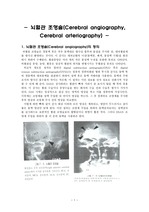 뇌혈관 조영술(Cerebral angiography)