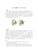 성인실습 case study 뇌경색