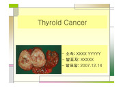 Thyroid Cancer(갑상선 암)