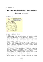 관상동맥우회술(Coronary Artery Bypass Grafting : CABG)