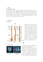 정형외과 케이스- 척추협착증(spinal stenosis)