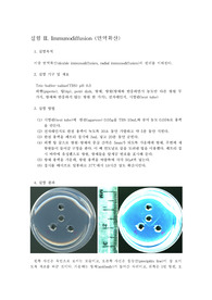 [면역학실험] 이중 면역확산 (double immunodiffusion)