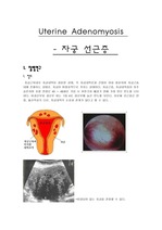 자궁선근증 질병고찰