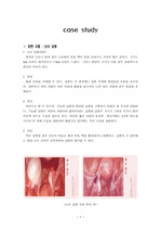 성인간호학 수술실 난소낭종CASE STUDY