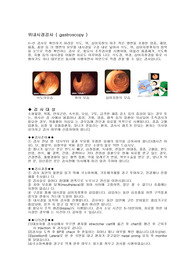 위내시경검사