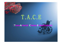 TACE (간동맥화학색전술)