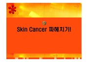 피부암(skin cancer)