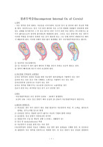 자궁경관무력증 문헌고찰