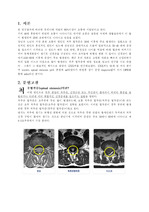 [성인간호학] 신경과 케이스- 척추관 협착증(spinal stenosis) case =>A+평가.