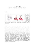 만성폐쇄성 폐질환(COPD)