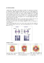 골수염(Osteoarthritis)
