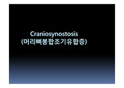 성형외과 머리뼈봉합조기유합증 craniosynostosis 선천성기형 원인 진단 치료 ppt