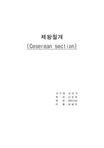 재왕절개 ceserean section