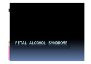 fetal alcohol syndrome (FAS)