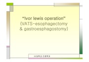 `Ivor lewis operation = VATS-esophagectomy & gastroesphagostomy`수술방법 ppt 자료