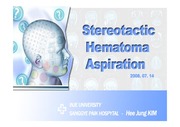 Stereotactic aspiration ppt수술간호, ICP 수술간호 ppt, 신경외과 수술간호 ppt