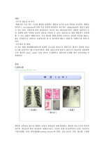 폐렴 Pneumonia-Case study