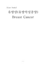 유방암 Case Study