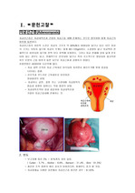 자궁선근종(Adenomyosis) 케이스스터디