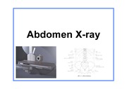 abdomen_x-ray