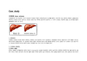 질병스터디 간경화증