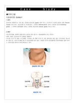 갑상선종 case study