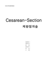 제왕절개, 제왕절개 분만, cesarean delivery, c-sec 케이스 스터디