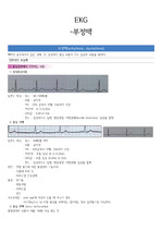 EKG 부정맥