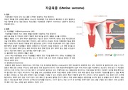 자궁육종(Uterine Sarcoma) CASE STUDY