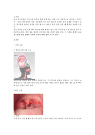 편도선염과 관련된 문헌고찰 케이스스터드