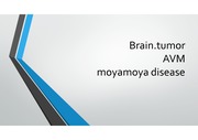 뇌종양, 뇌혈관기형 avm, moyamoya