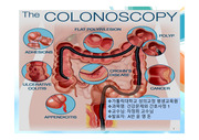 대장내시경 검사 PPT