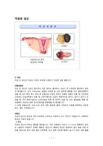 자궁외 임신, 자궁근종, 자궁경부암 레포트