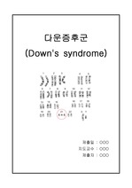 의치약 선수과목  일반생물 과제) 다운증후군 (Down's syndrome)