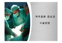 척추질환 증상과 수술방법