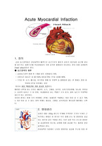 심근경색 case study