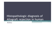 Histopathologic diagnosis of Allograft rejection in human & pig xenograft - kidney