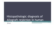 Histopathologic diagnosis of Allograft rejection in human & pig xenograft - Liver