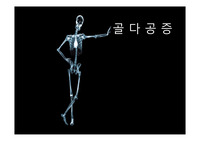 골다공증, 골다공증 예방, 골다공증 운동, 골다공증 환자 운동 프로그램