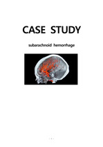 SAH case study